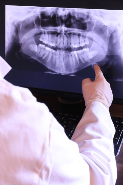 Best Emergency Gum Treatment in Hoquiam, WA