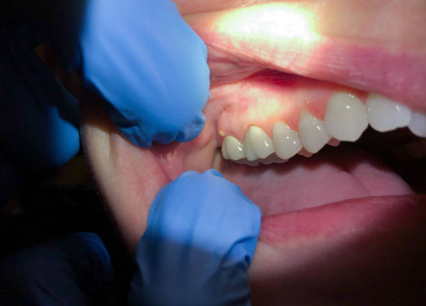 Best Pediatric Emergency Dentist in Hoquiam, WA